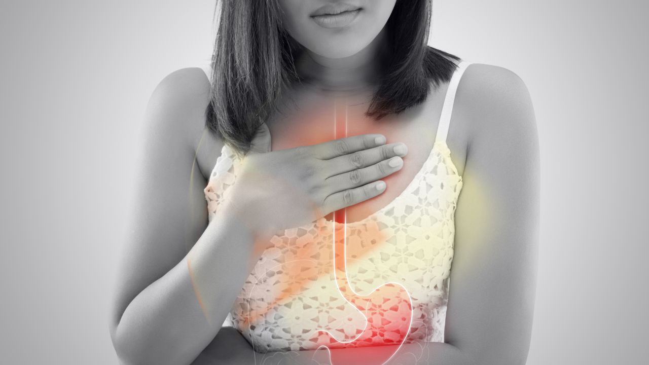 GERD, acid reflux and heartburn symptoms