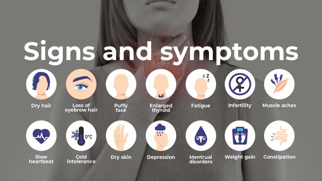 signs and symptoms of hypothyroidism