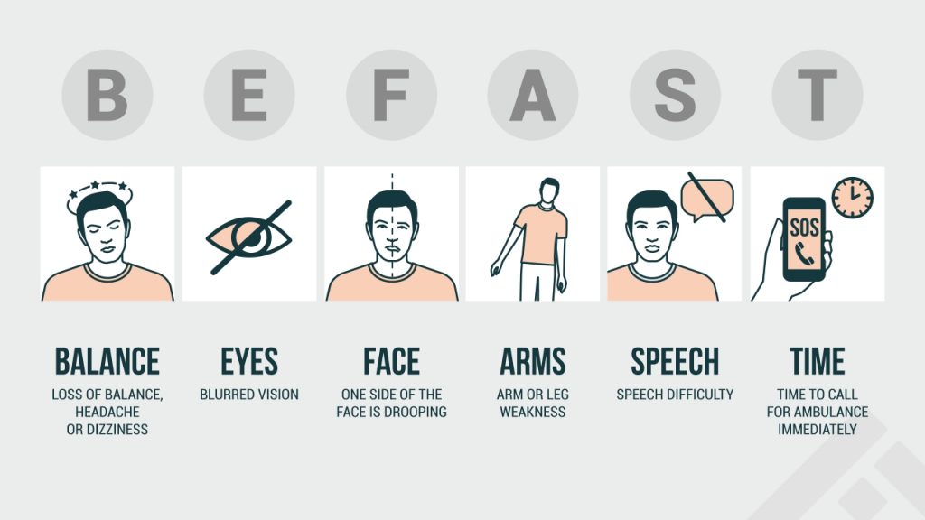 symptoms of stroke - BEFAST