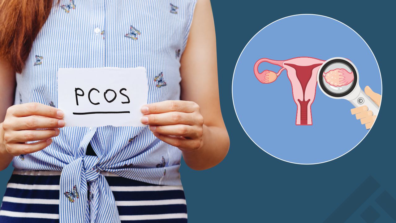 PCOS