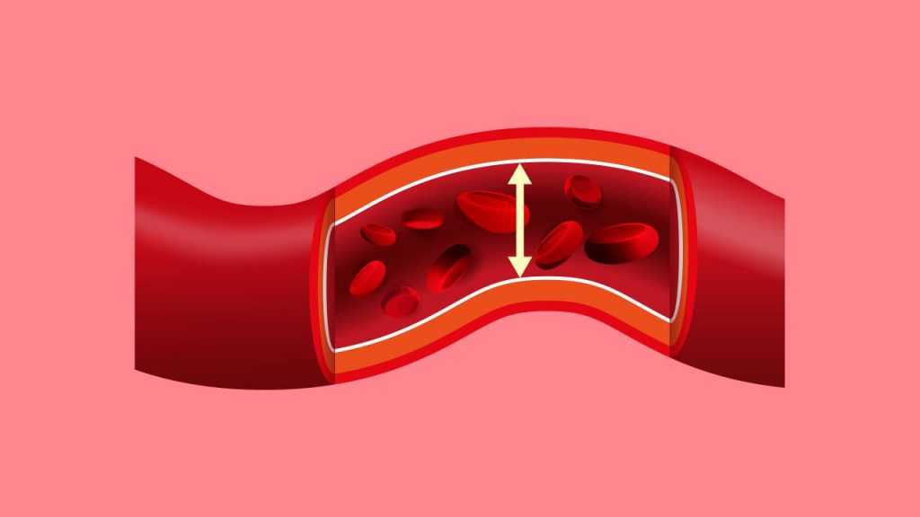 hypertensive heart disease