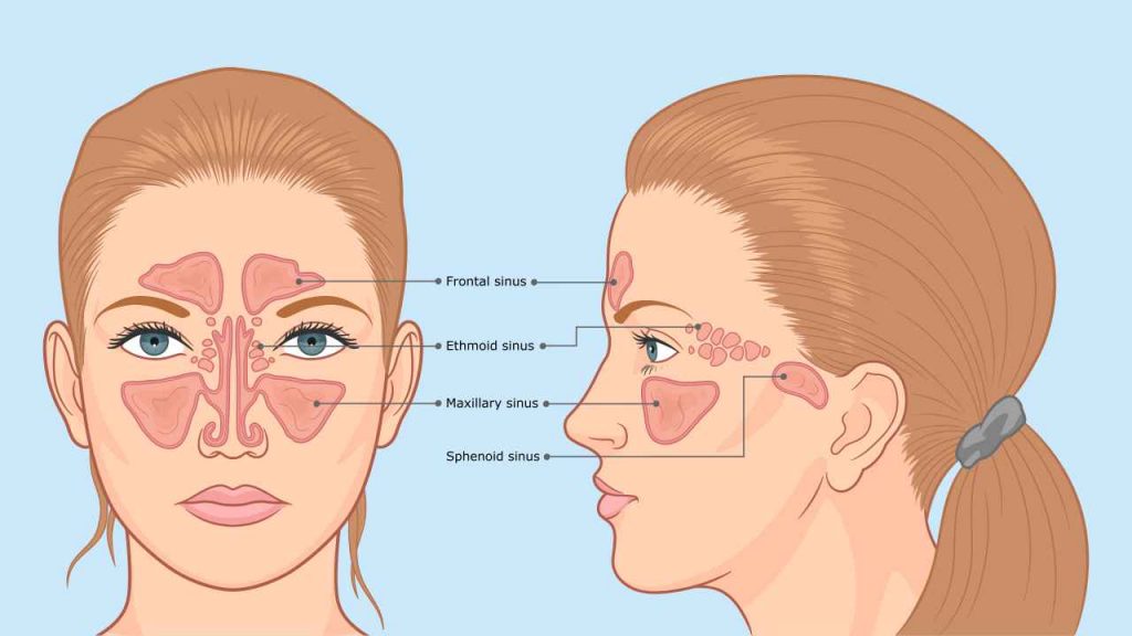 Types of sinuses